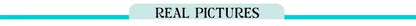 Sequins Lace Splicing Dress Women's Sexy V-veck Shiny Sleeveless Backless Sling Dresses 2026 Spring Summer New Ladies Beach Robe